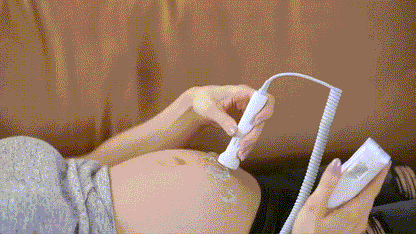 Doppler foetal - Écoute-Cœur Bébé | RONDOR
