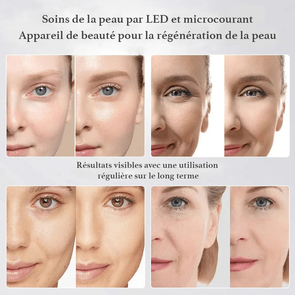 Appareil Facial 5‑en‑1 – LED Multicolore, EMS & Purification - Rondor