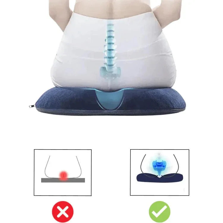 Bouée Coccyx - ErgoSeat - Rondor