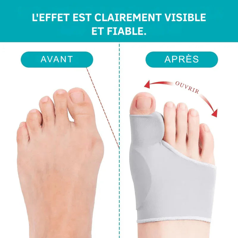 CompressCare - Correcteur d'hallux valgus pour adolescents | Sans douleur et discret - Rondor