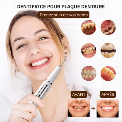 Détartreur dentaire à ultrasons USB – nettoyage des dents à domicile - Rondor