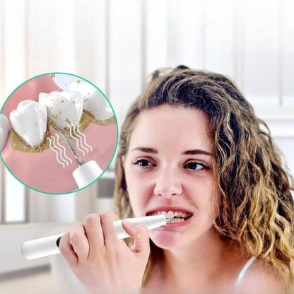 Détartreur dentaire à ultrasons USB – nettoyage des dents à domicile - Rondor