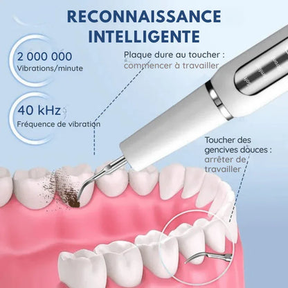 Détartreur dentaire à ultrasons USB – nettoyage des dents à domicile - Rondor