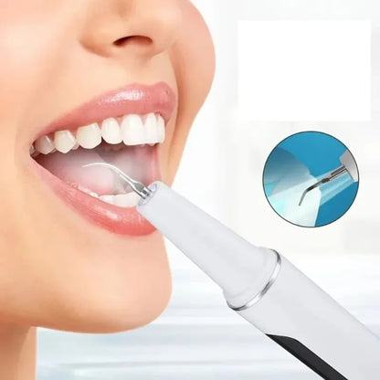Détartreur dentaire à ultrasons USB – nettoyage des dents à domicile - Rondor