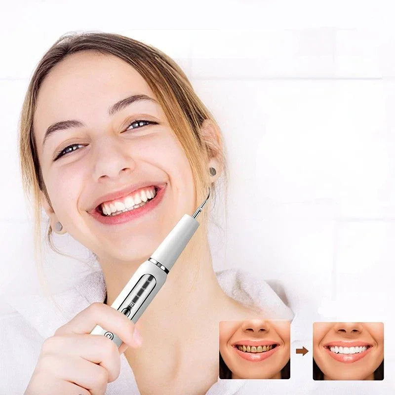 Détartreur dentaire à ultrasons USB – nettoyage des dents à domicile - Rondor