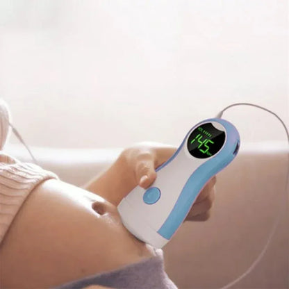 Doppler Fœtal à Ultrasons ChupiCare™ - Écoutez les battements du coeur de votre bébé à la maison - Rondor