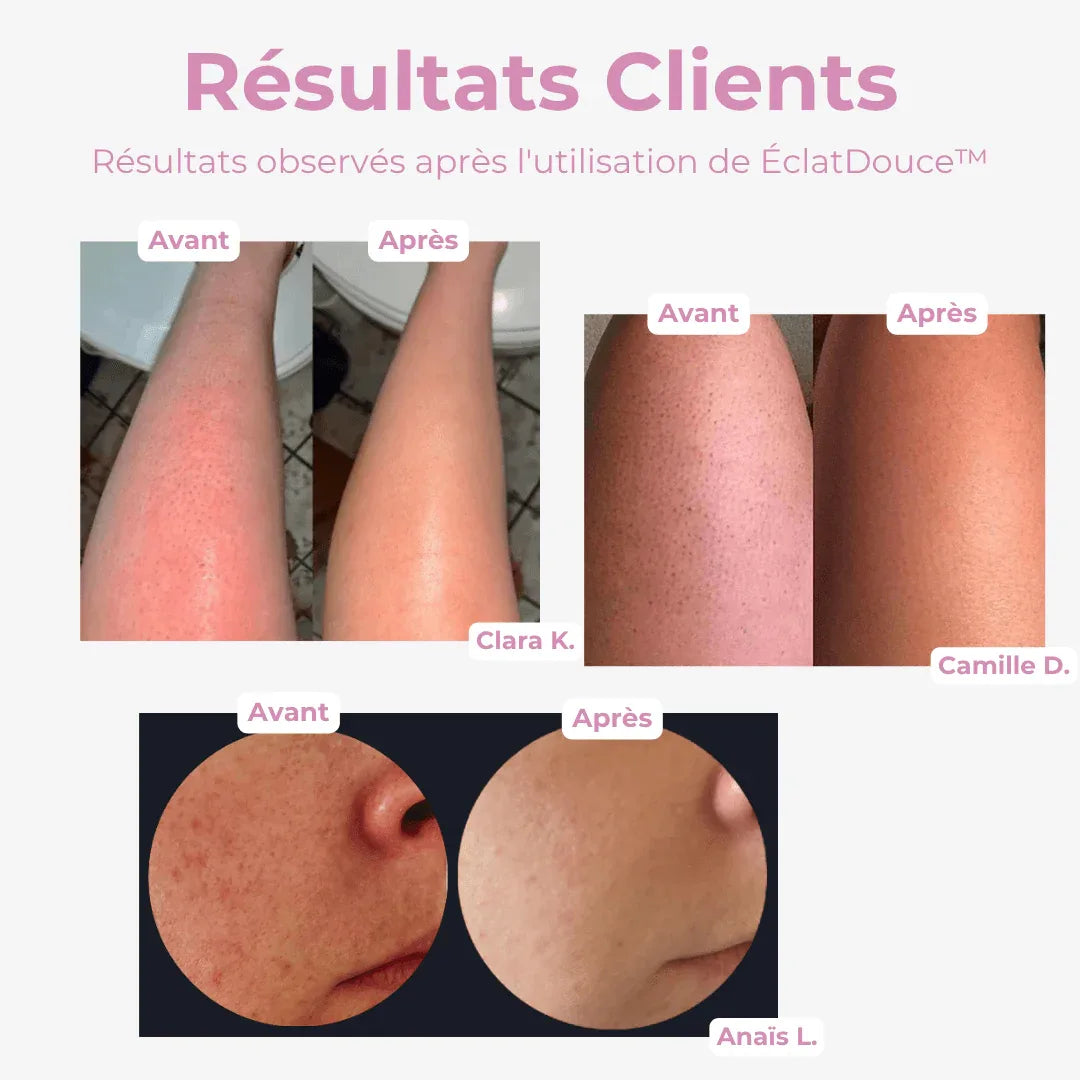 ÉclatDouce Éponge Exfoliante pour le Corps - Rondor