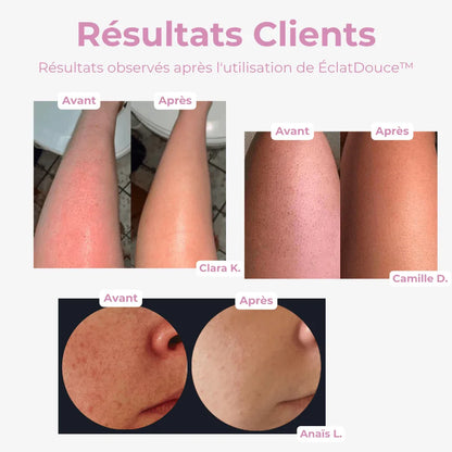 ÉclatDouce Éponge Exfoliante pour le Corps - Rondor