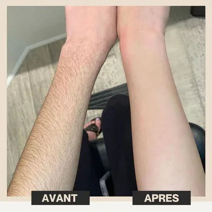 Épilateur Laser Pro à Lumière Pulsée - LumiSmooth™ - Rondor