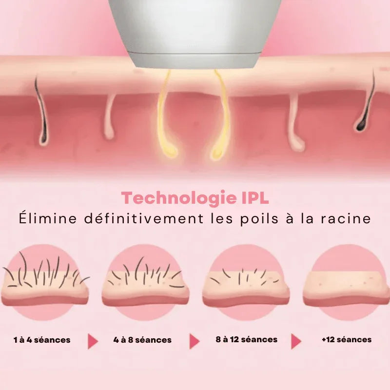 Épilateur Laser Pro à Lumière Pulsée - LumiSmooth™ - Rondor
