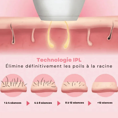 Épilateur Laser Pro à Lumière Pulsée - LumiSmooth™ - Rondor