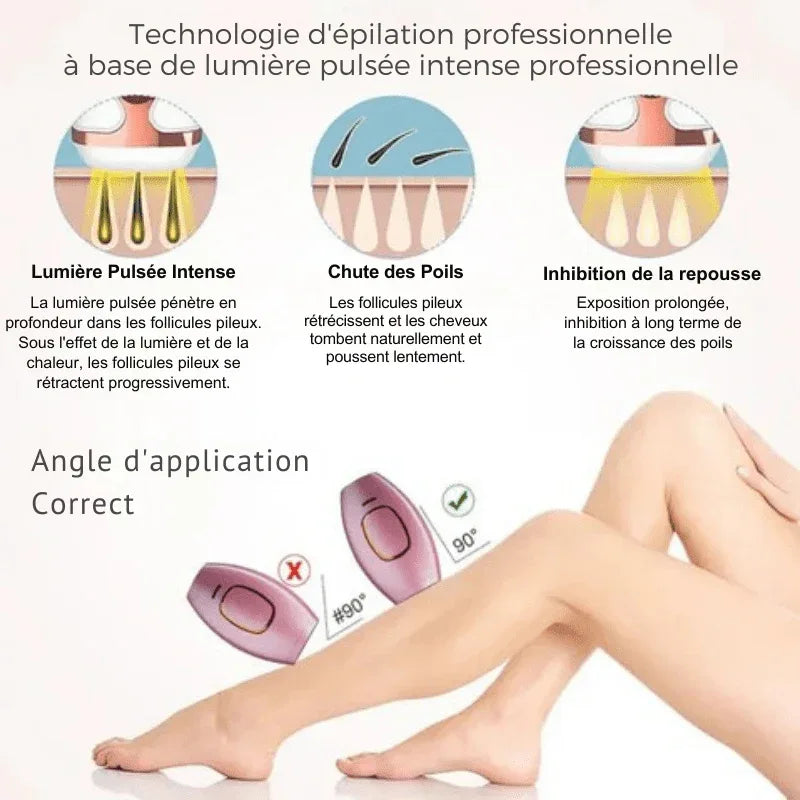 Épilateur Laser Pro à Lumière Pulsée - LumiSmooth™ - Rondor