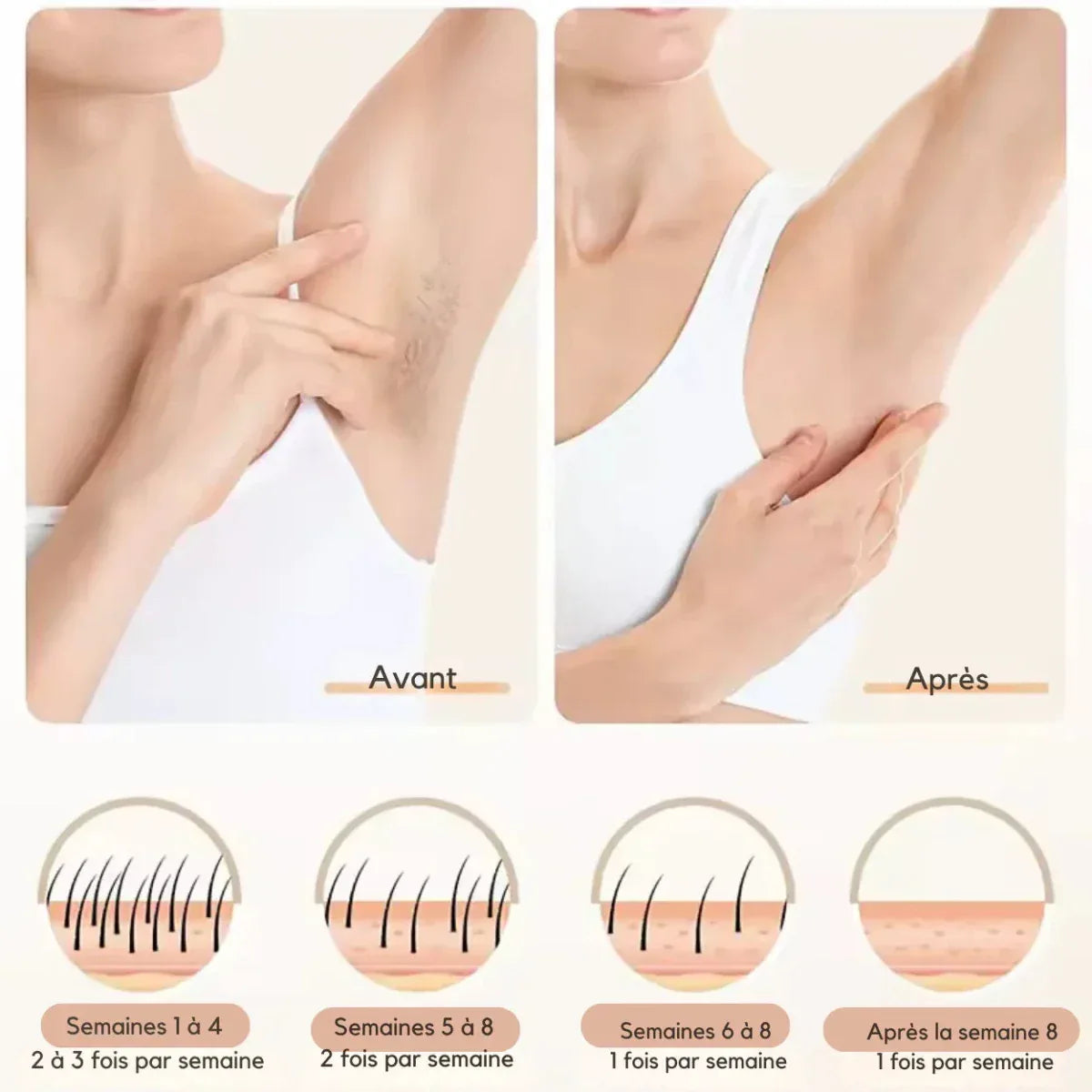 Épilateur Lumière Pulsée IPL 3 - en - 1 – Épilation Durable, Rajeunissement & Soin Anti - Imperfections - Rondor