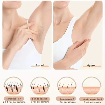 Épilateur Lumière Pulsée IPL 3 - en - 1 – Épilation Durable, Rajeunissement & Soin Anti - Imperfections - Rondor