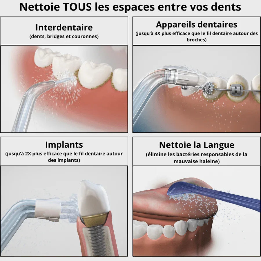 Hydropulseur Dentaire - Rondor