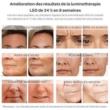 Lisseur Contour Yeux & Visage LED 7 couleurs + Vibration - Rondor