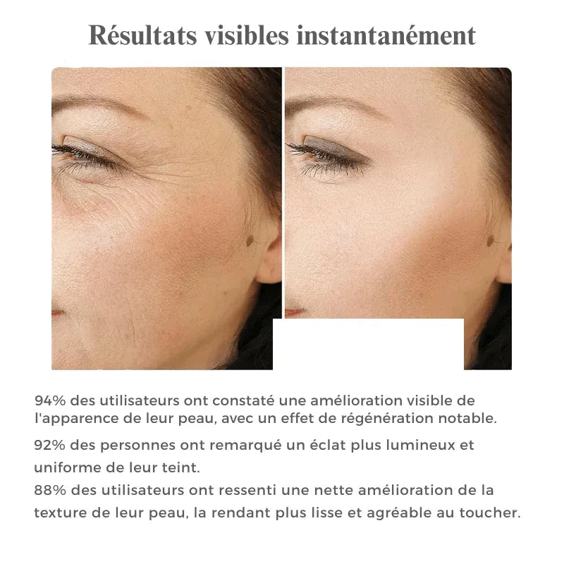 Lisseur Contour Yeux & Visage LED 7 couleurs + Vibration - Rondor