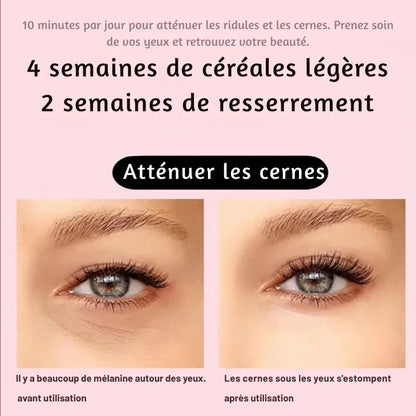 Lisseur Contour Yeux & Visage LED 7 couleurs + Vibration - Rondor