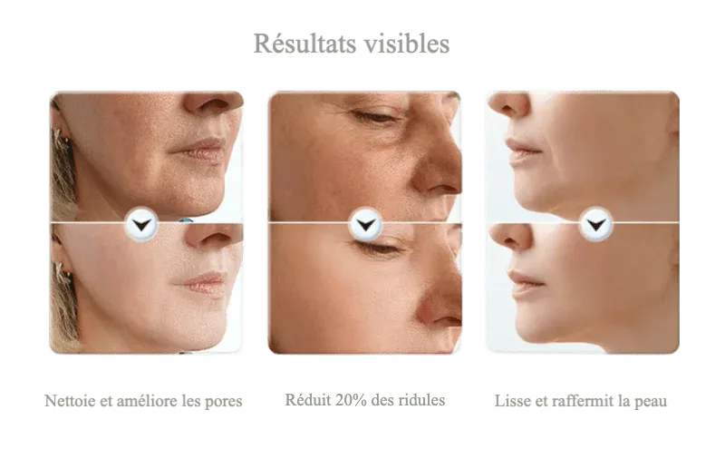 Masseur EMS Visage & Cou – Fermeté & Contour Remodelé - Rondor
