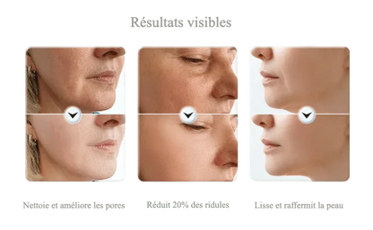 Masseur EMS Visage & Cou – Fermeté & Contour Remodelé - Rondor