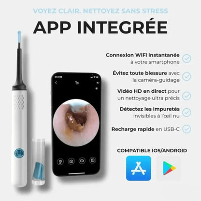 Otoscope - Nettoyeur d'oreille avec caméra intéfrée - Rondor