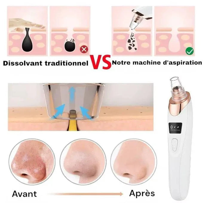 PoreGlow™ Éliminateur de points noirs - Rondor
