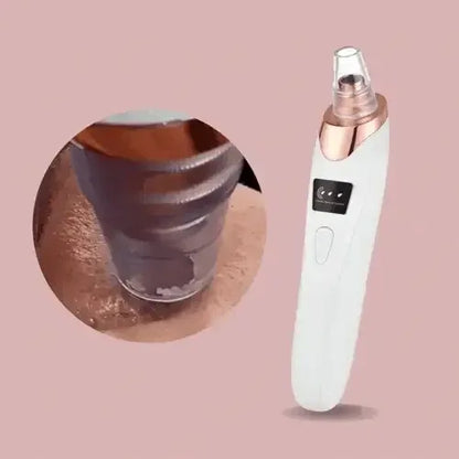 PoreGlow™ Éliminateur de points noirs - Rondor