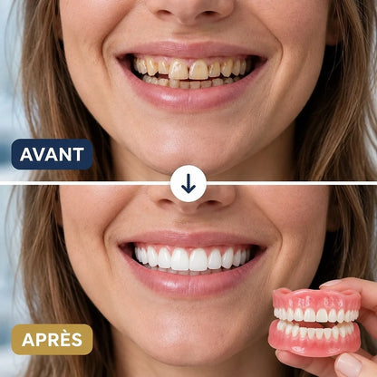 Prothèse Dentaire Amovible Silicone