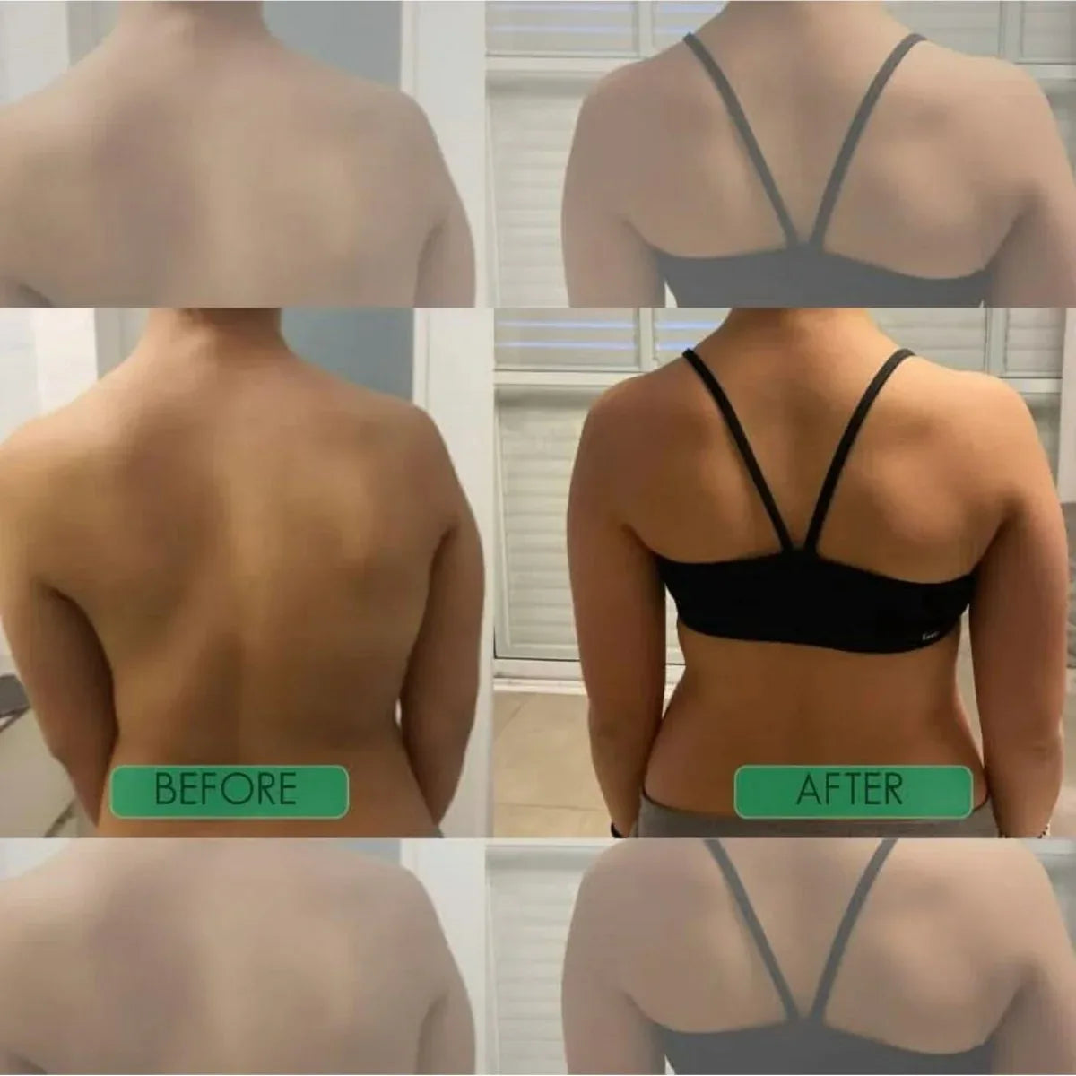 RondorFit Pro™ - Correcteur de posture , Soulagement instantané du dos - Rondor