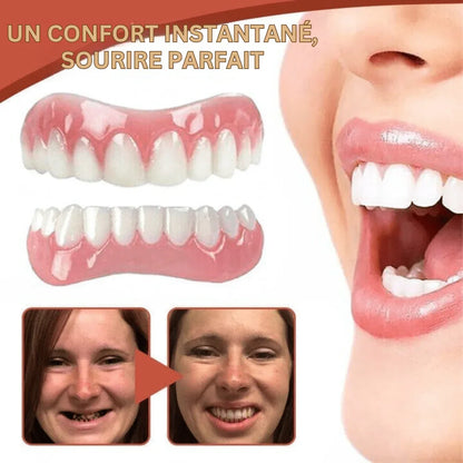 SmileGuard | Vous pouvez ajuster vos prothèses pour qu'elles s'adaptent parfaitement à chaque fois - Rondor