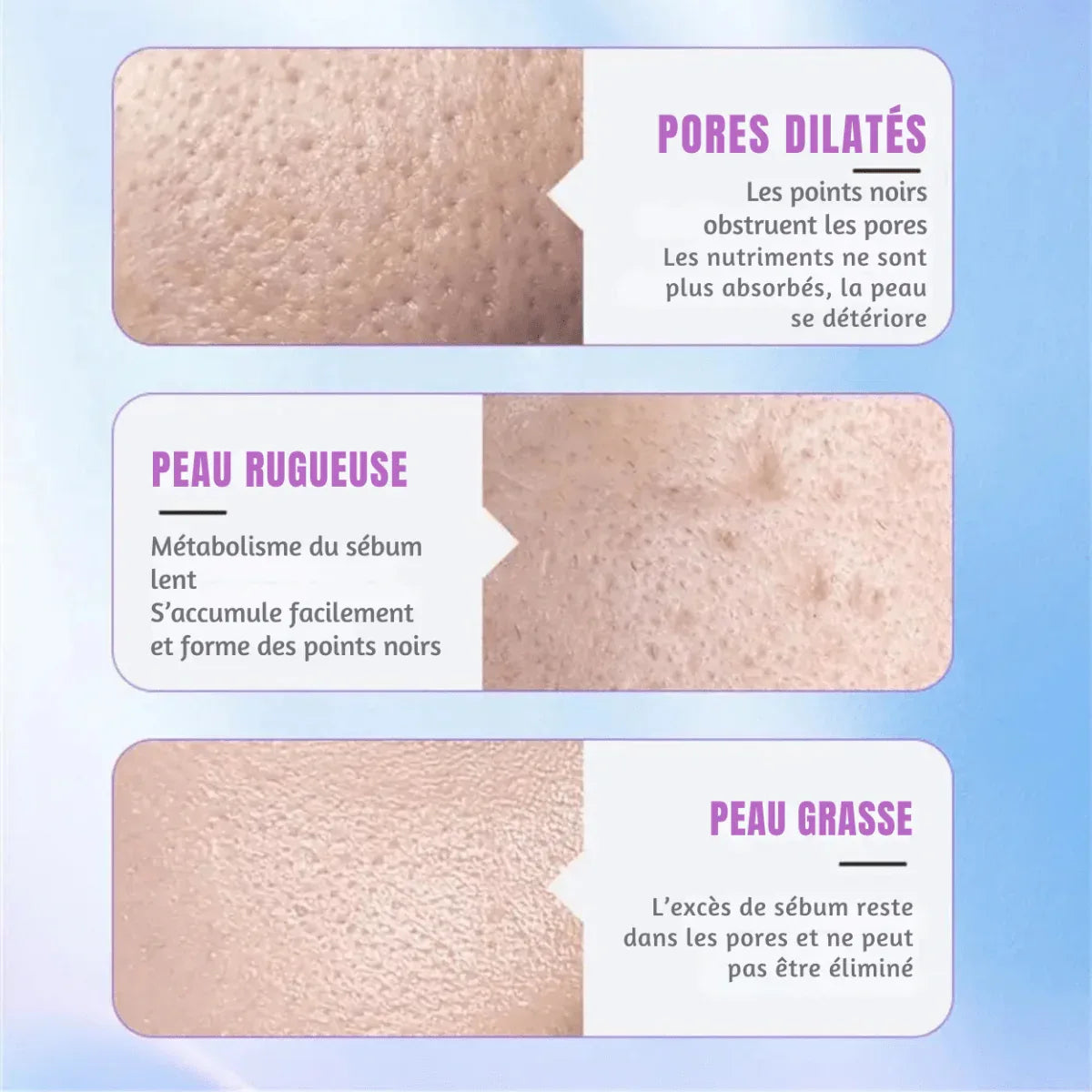 Spatule Ultrasonique Visage - Rondor