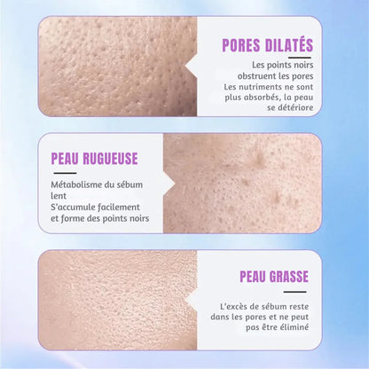 Spatule Ultrasonique Visage - Rondor