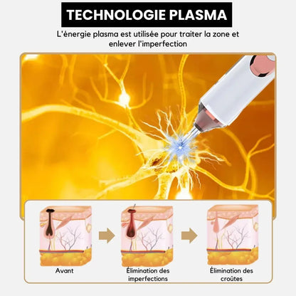 Stylo Laser Plasma Anti - taches - Rondor