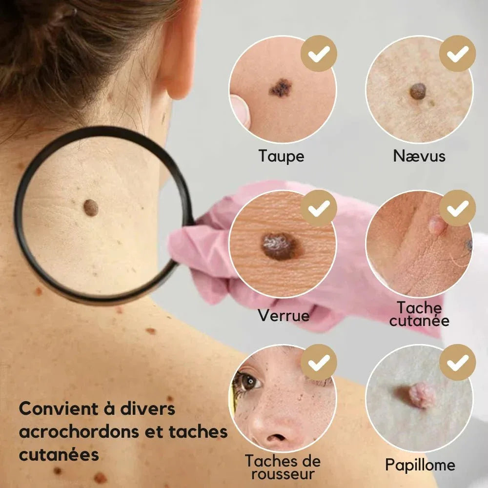 Stylo Laser Plasma Anti - taches - Rondor