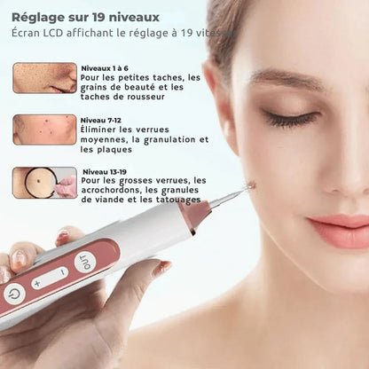 Stylo Laser Plasma Anti - taches - Rondor