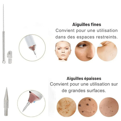 Stylo Laser Plasma Anti - taches - Rondor