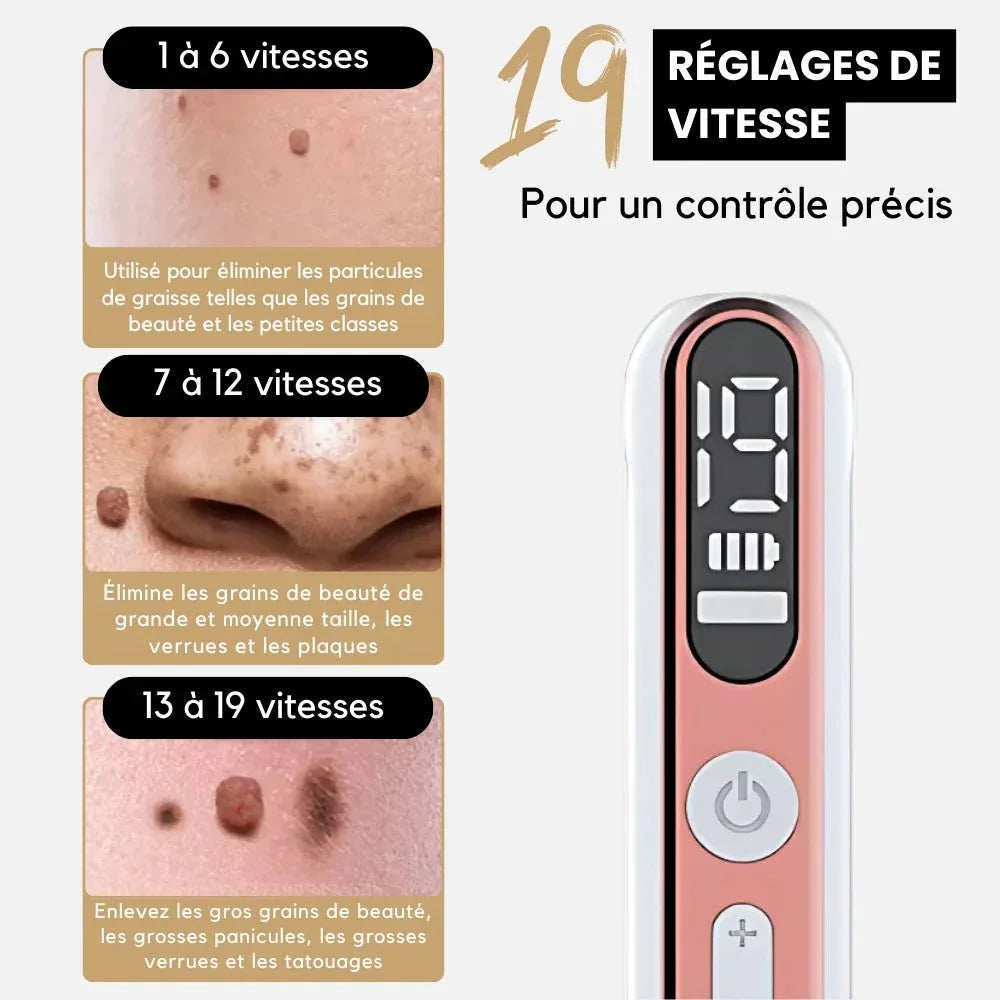 Stylo Laser Plasma Anti - taches - Rondor