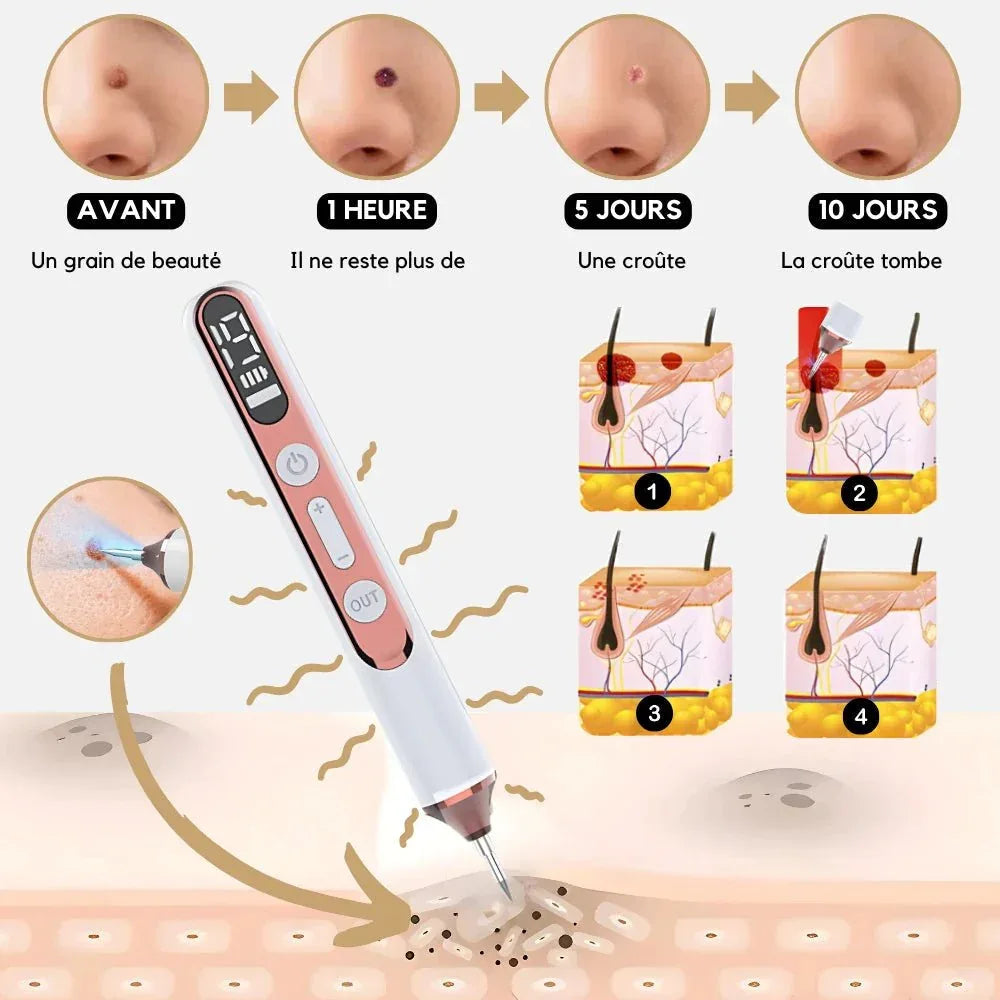 Stylo Laser Plasma Anti - taches - Rondor