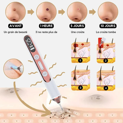 Stylo Laser Plasma Anti - taches - Rondor
